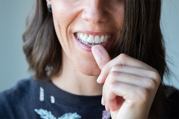 Do Braces and Invisalign Work Differently