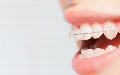 Common Orthodontic Treatment