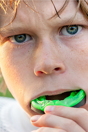 Mouth guards at Walton & Maready Orthodontics